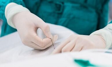 Pelbise txiki baten barizeak diagnostikatzea