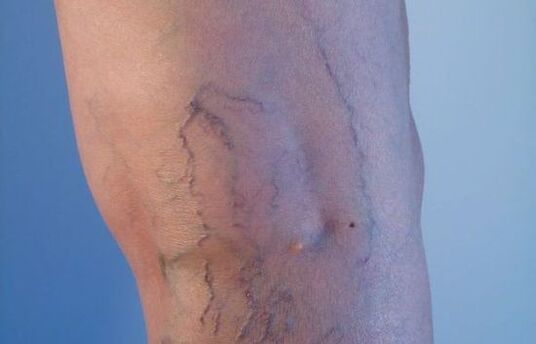 emakumezkoen hanketan barizeak